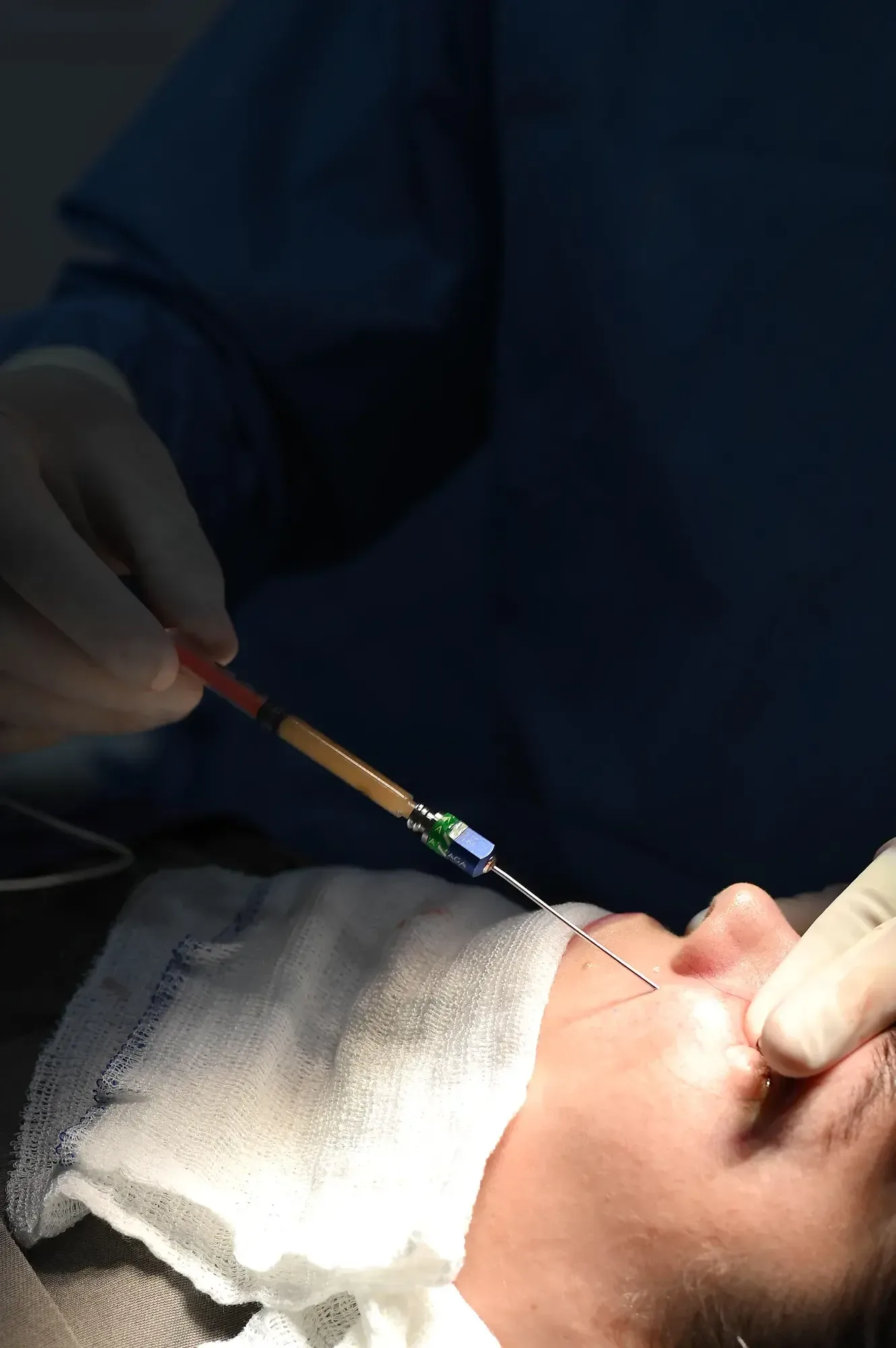 Procedimento facial — detalhe
